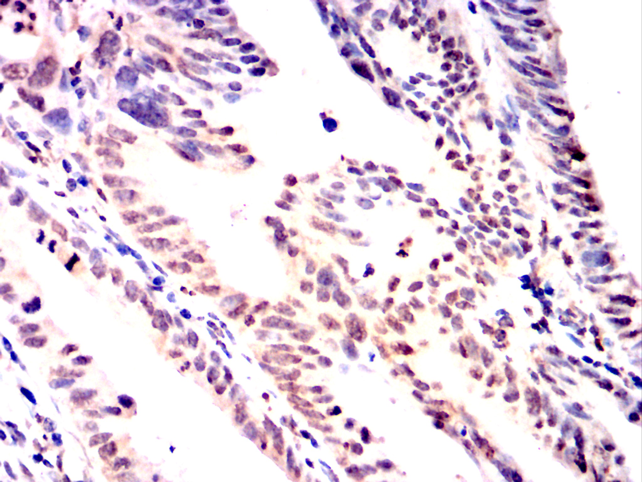 		IHC